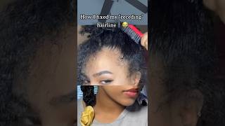 How I fixed my RECEDING hairline curlyhair naturalhair hairstyles [upl. by Nnaul]