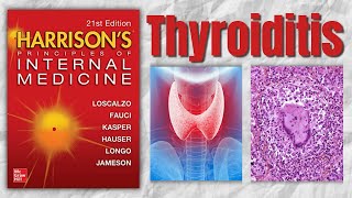 THYROIDITIS  Classification  Causes  Clinical Features  Treatment  Harrision [upl. by Marquita]