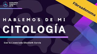 Hablemos de mi citología Fibroadenoma [upl. by Imot]