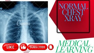 How to read Chest xray Normal chest xray CXR Anatomy chestxray [upl. by Inajar]