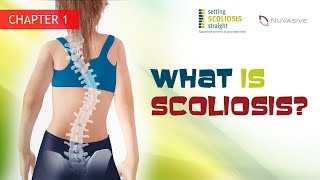 Ch1  What is Scoliosis [upl. by Adrahs]