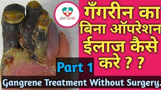 Gangrene  Prevent Amputation  Dr Vivek Jaju  Hindi [upl. by Belter598]