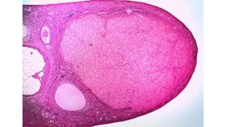 Ovary Corpus Luteum [upl. by Nrek]