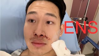 Septoplasty and Turbinate Reduction 2 Month Recovery and Review [upl. by Doralia87]