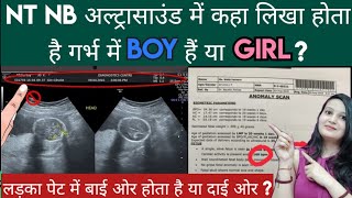 Ultrasound me Scan dekhkar kese pta lgaye Boy hoga ya Girl Gender prediction by Ultrasound picture [upl. by Limann150]