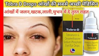 ✅Tobra D Drops आंखों में जलन  खटक  लाली  चुभन  एलर्जी  इन सब में दे तुरंत राहत side effects [upl. by Anisah]