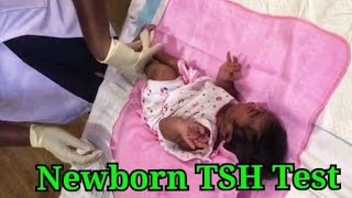 Newborn TSH Test  Thyroid Stimulating Hormone Test  Ninewells Hospital  Sri Lanka [upl. by Ulick]