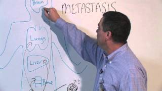 How Cancer Spreads Metastasis  Michael Henry PhD [upl. by Hansel253]