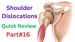 Shoulder dislocations  Anterior dislocation  Posterior dislocation  Inferior dislocation [upl. by Stanislaw]