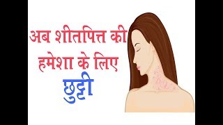 अब शीतपित्त की हमेशा के लिए छुट्टी II Urticaria Treatment  Dr Parmeshwar Arora [upl. by Gelb]