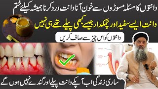 Danton Se Khoon Aana  Gum Bleeding Treatment At Home  Masoro Se Khoon Aane Ka Ilaj Dr Sharafat Ali [upl. by Fayina508]