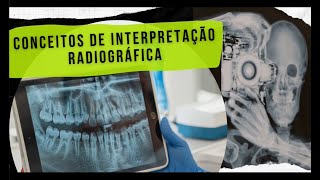 Interpretação Radiográfica Com Diagnósticos [upl. by Anrev]