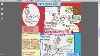 SESSIONS for NURSES 10  CARDIOGENIC AND SEPTIC SHOCK [upl. by Pacificia841]