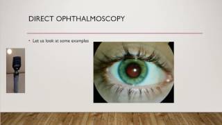 How to do fundoscopy A direct ophthalmoscopy OSCE [upl. by Domeniga237]