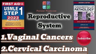 Usmle step 1Vaginal tumorsCervical carcinoma from PathomaReproductive system pathologyUrduHindi [upl. by Andre711]