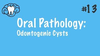 Oral Pathology  Odontogenic Cysts  INBDE ADAT [upl. by Coplin920]