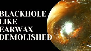 Blackhole Like Earwax Demolished [upl. by Akenihs]