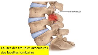 Causes des troubles articulaires des facettes lombaires [upl. by Olraced172]