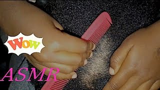 ASMR SCALP SCRATCHINGPIMPLE POPPINGDANDRUFF FLAKES REMOVALasmr scalpscratching pimplepopping [upl. by Ezarra]