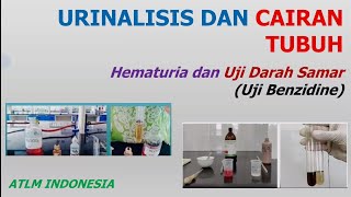 Hematuria dan Uji Darah Samar Benzidine Test  Urinalisis  Carik Celup Blood [upl. by Nhtanhoj825]