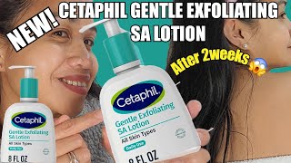 NEW CETAPHIL GENTLE EXFOLIATING SA LOTION FOR SKIN WITH COLOUR ALL SKIN TYPES [upl. by Natassia]