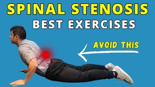 Best Exercises for Spinal Canal Stenosis Pain Relief [upl. by Carree]