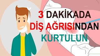 Diş Ağrısına Ne İyi Gelir  Diş Ağrısına Kesin Çözüm [upl. by Lewej704]