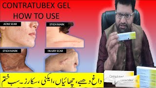 contractubex gel review  Acne scar removal cream  contractubex gel how to use  scar treatment gel [upl. by Pinkham]