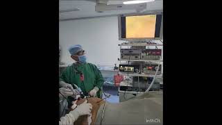 Basics of laproscopic Bariatric Surgery [upl. by Blondell]