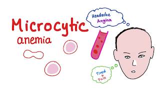 Microcytic Anemia introduction [upl. by Verras]