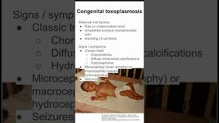 Congenital toxoplasmosis [upl. by Reemas]