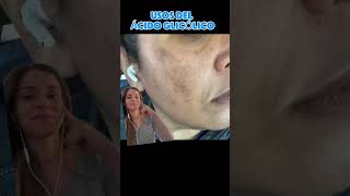 Para qué sirve el ácido glicólico skincare drapascali acidoglicolico [upl. by Juliette]