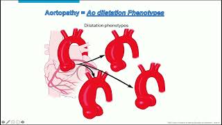 ECHO ASSESMENT OF AORTA MAYO CLINIC [upl. by Enneira639]