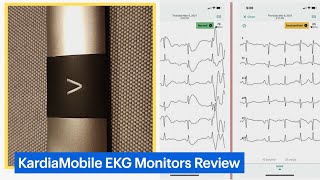 KardiaMobile Personal EKG Monitors Review [upl. by Rother]