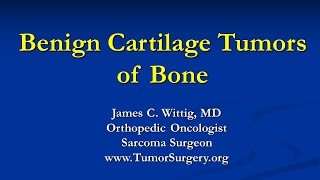 Orthopedic Oncology Course  Benign Cartilage Tumors Osteochondroma Chondroblastoma  Lecture 5 [upl. by Ball173]