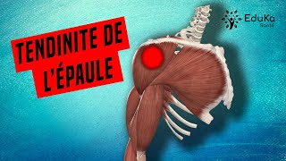 COMPRENDRE LA TENDINITE DE LÉPAULE Explications professionelles [upl. by Oremoh]