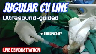 Jugular CV line ultrasound guided  central venous catheter CVC  vena dalam [upl. by Lane]