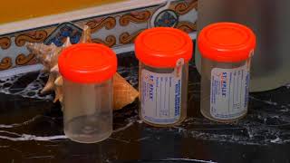 How to Collect Sputum Samples [upl. by Atteselrahc]