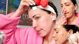 LIMPIEZA FACIAL CASERA con MASAJES RELAJANTES 💆 ASMR para dormir [upl. by Banwell]