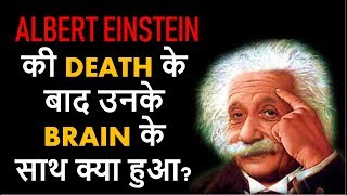 Albert Einstein की Death के बाद उनके Brain के साथ क्या हुआ The brain of Albert Einstein [upl. by Suhpesoj]