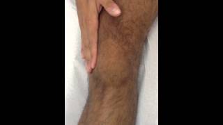 Knee Effusion Test  Selfassessment Swipe Test [upl. by Assitruc]