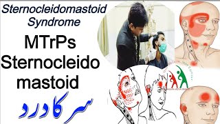 STERNOCLEIDOMASTOID SYNDROMEMYOFICAIL TRIGGER POINTS SCM PART IHEADACHEسر کا دردSCALP PAIN [upl. by Chery]