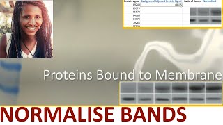 📊 WESTERN BLOT NORMALISATION USING HOUSEKEEPING GENE or TOTAL PROTEIN STAIN [upl. by Saidel751]