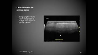 Salivary Glands [upl. by Saville]