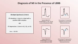 Intro to EKG Interpretation  Myocardial Infarctions Part 2 of 2 [upl. by Harolda592]