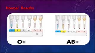 ABO discrepancy and transfusion practice part one By Dr Mohamed Samir [upl. by Nuahsyd]