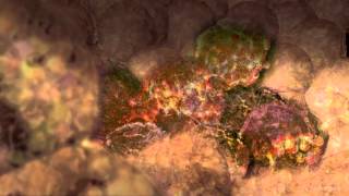 Cancer Cells Undergoing Mitosis [upl. by Caughey446]