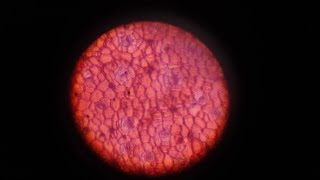 REAL LENTICELS and STOMATA [upl. by Oalsecnew388]