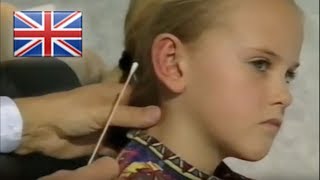 Dr Waldemar Merck Ear Surgery Ear Pinning Ear Correction Otoplasty [upl. by Elicia]