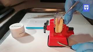 Endodontic treatment of the single rooted tooth Part 5 Placement of interappointment medicament [upl. by Ellac]